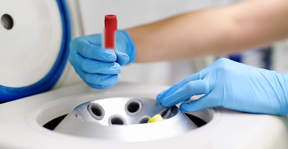 PRP Plasma Rico en Plaquetas — centrífuga de laboratorio